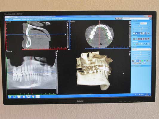 Dr Vincent Decrocq, chirurgien dentiste à Colmar